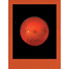 Subotzky_Retinal.jpg